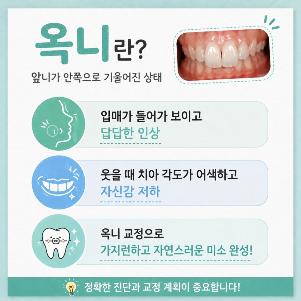 옥니 교정 관련 이미지 2