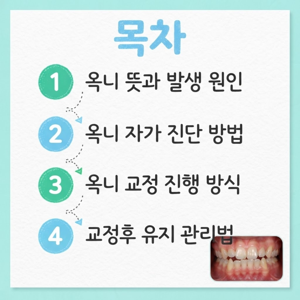 옥니 교정 관련 이미지 3