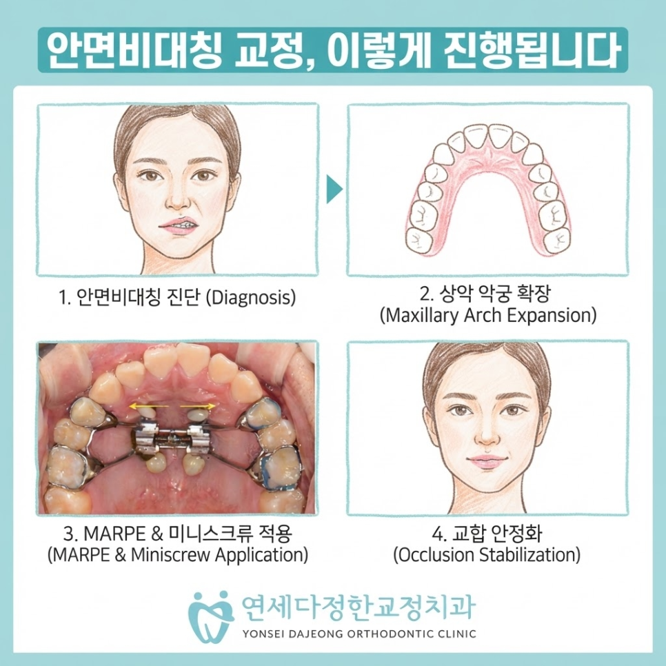 안면비대칭 치아교정 관련 이미지 3