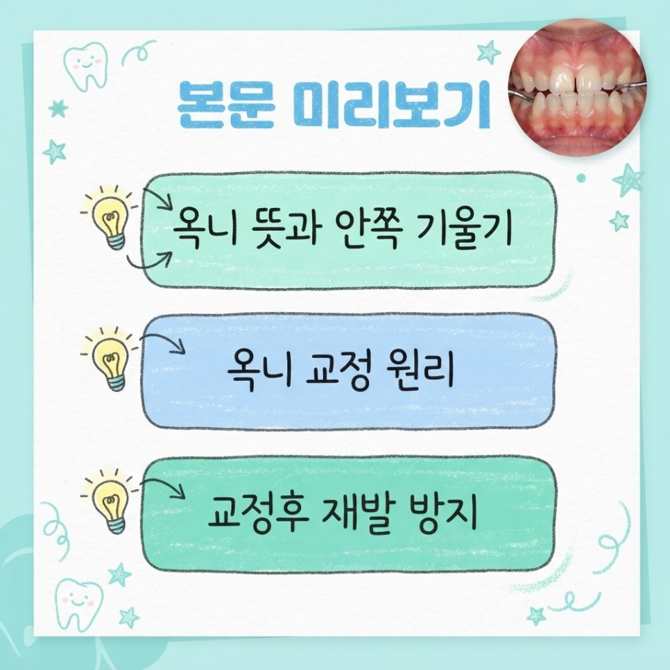 옥니 교정 관련 이미지 4