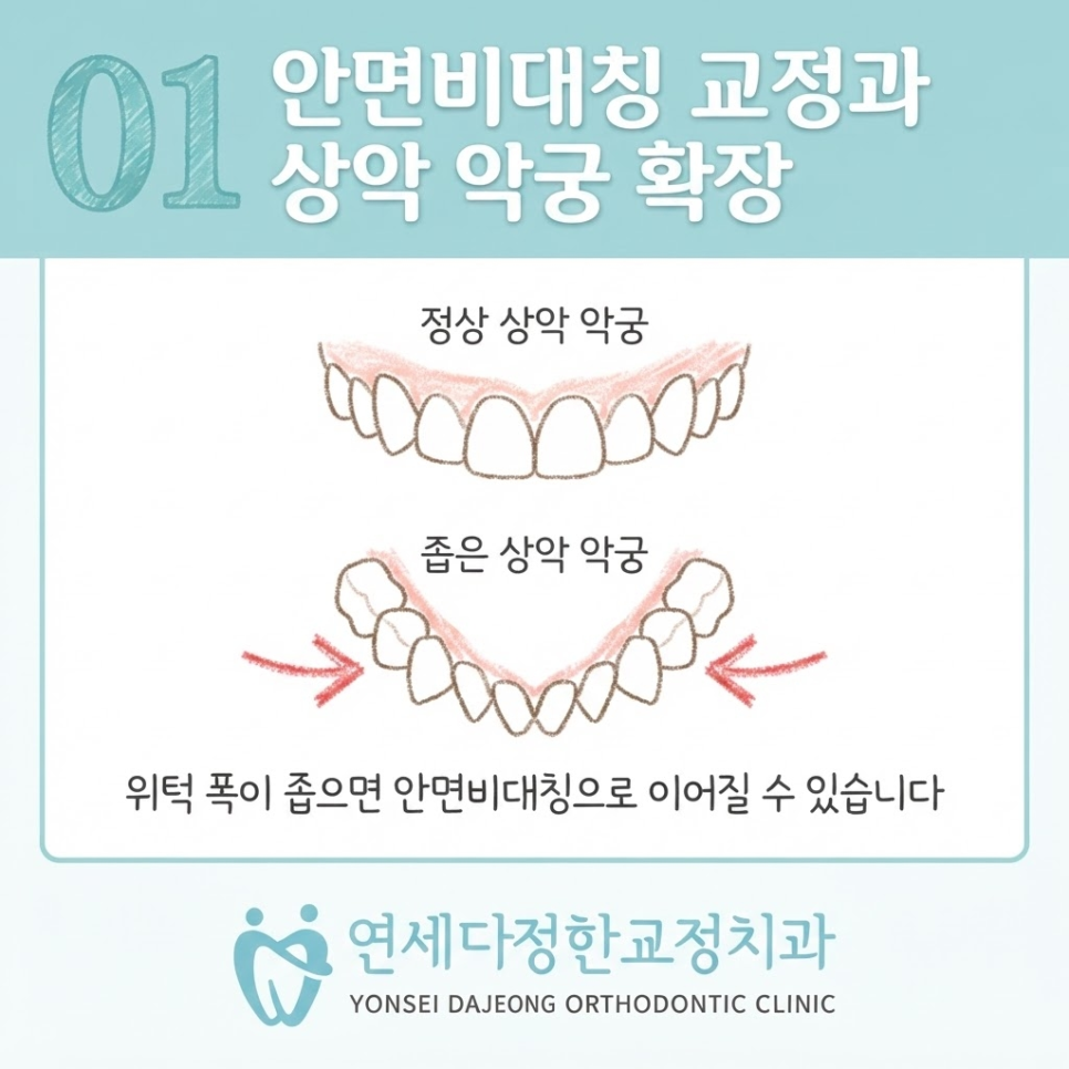 안면비대칭 치아교정 관련 이미지 5