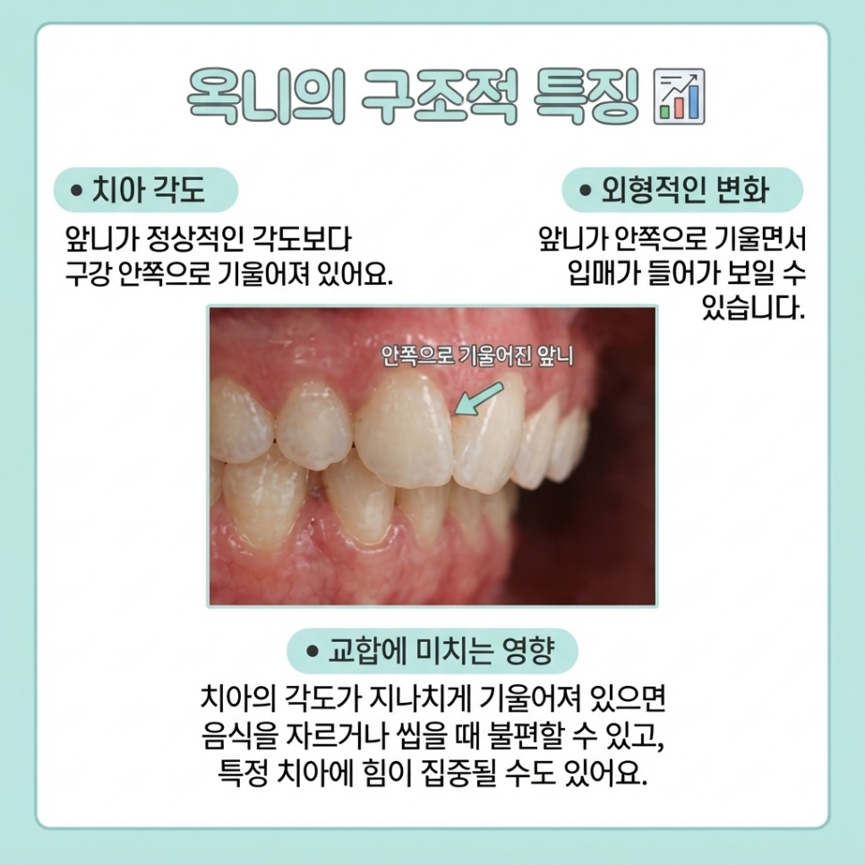 옥니 교정 관련 이미지 6