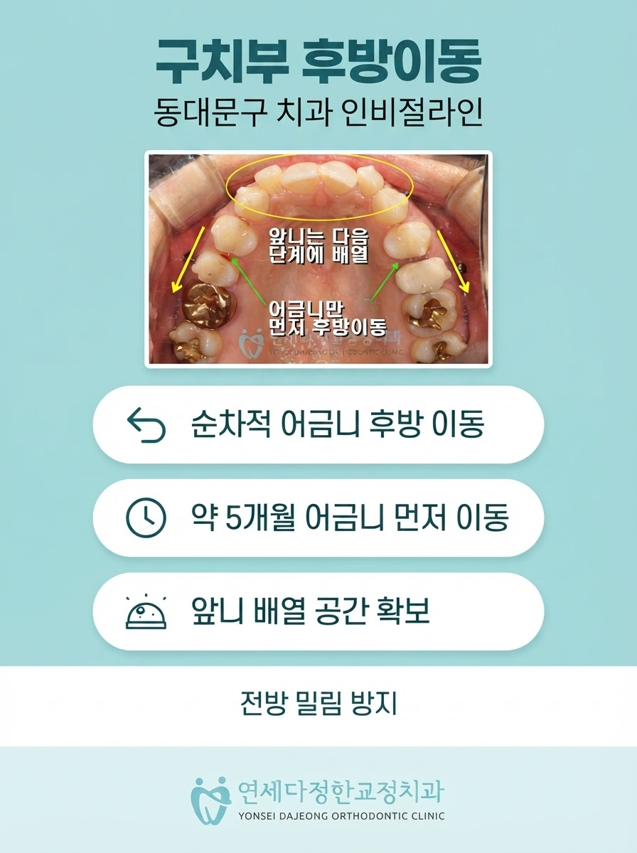 인비절라인 교정 비용 관련 이미지 6
