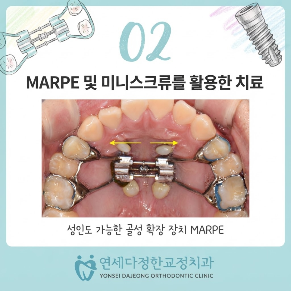 안면비대칭 치아교정 관련 이미지 7