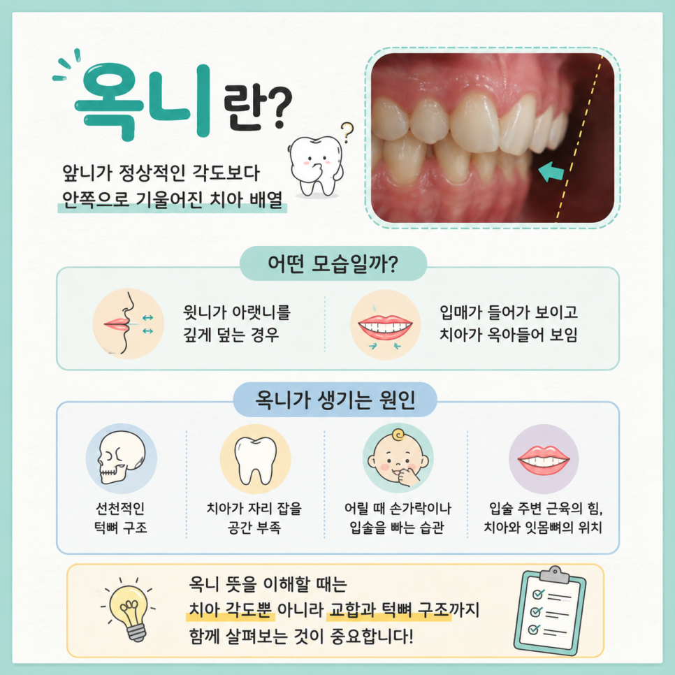 옥니 교정 관련 이미지 7