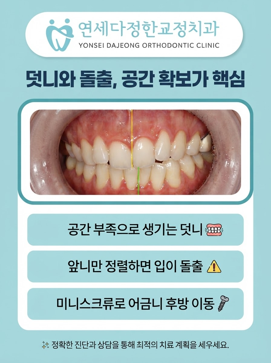 제기동 교정치과 추천 관련 이미지 7