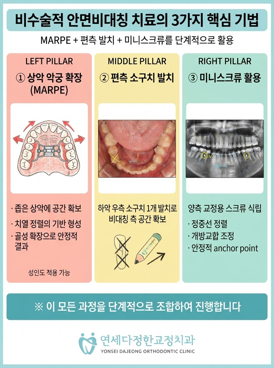 안면비대칭 치아교정 관련 이미지 8