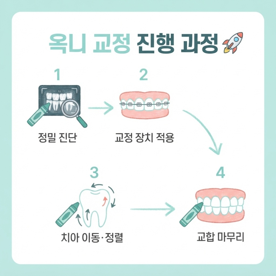 옥니 교정 관련 이미지 10