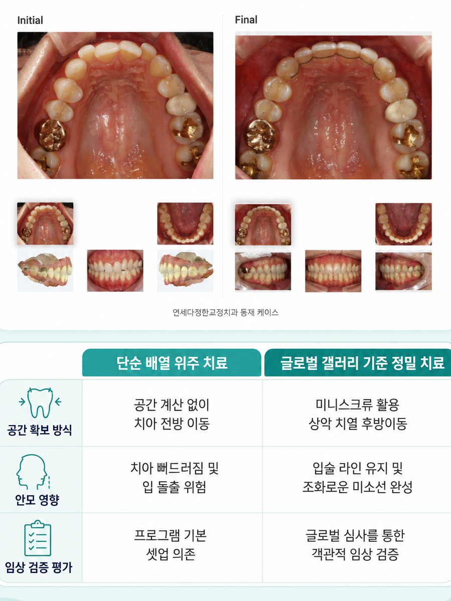 제기동 교정치과 추천 관련 이미지 10