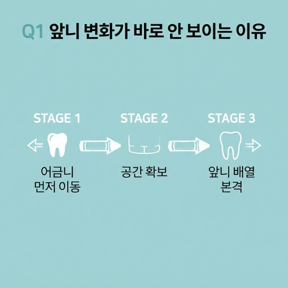 인비절라인 교정 비용 관련 이미지 10