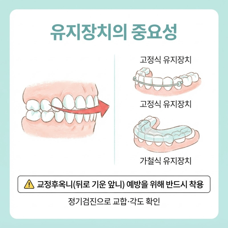 옥니 교정 관련 이미지 11