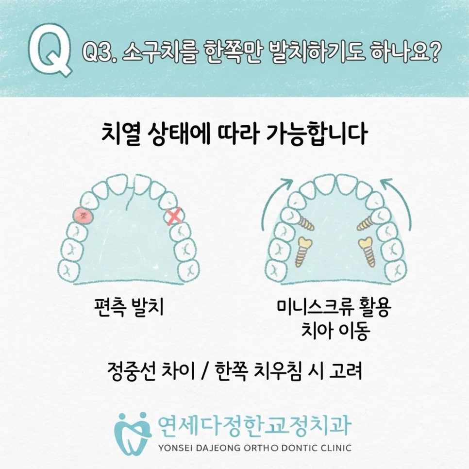 안면비대칭 치아교정 관련 이미지 13