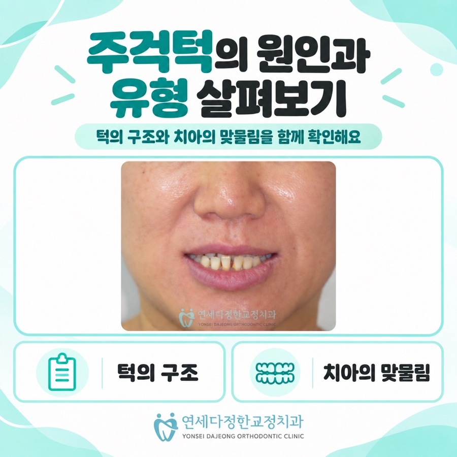 주걱턱 비수술교정