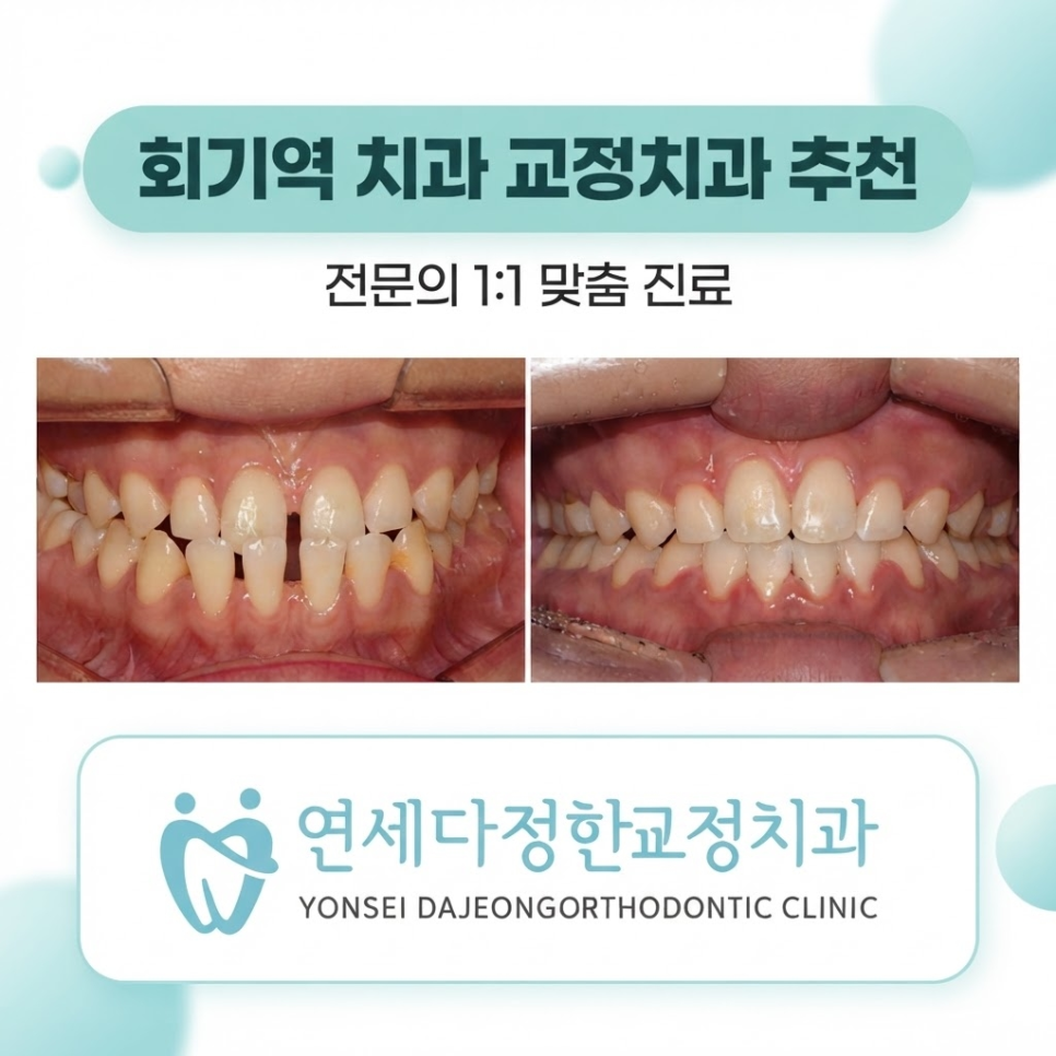 회기역 교정치과