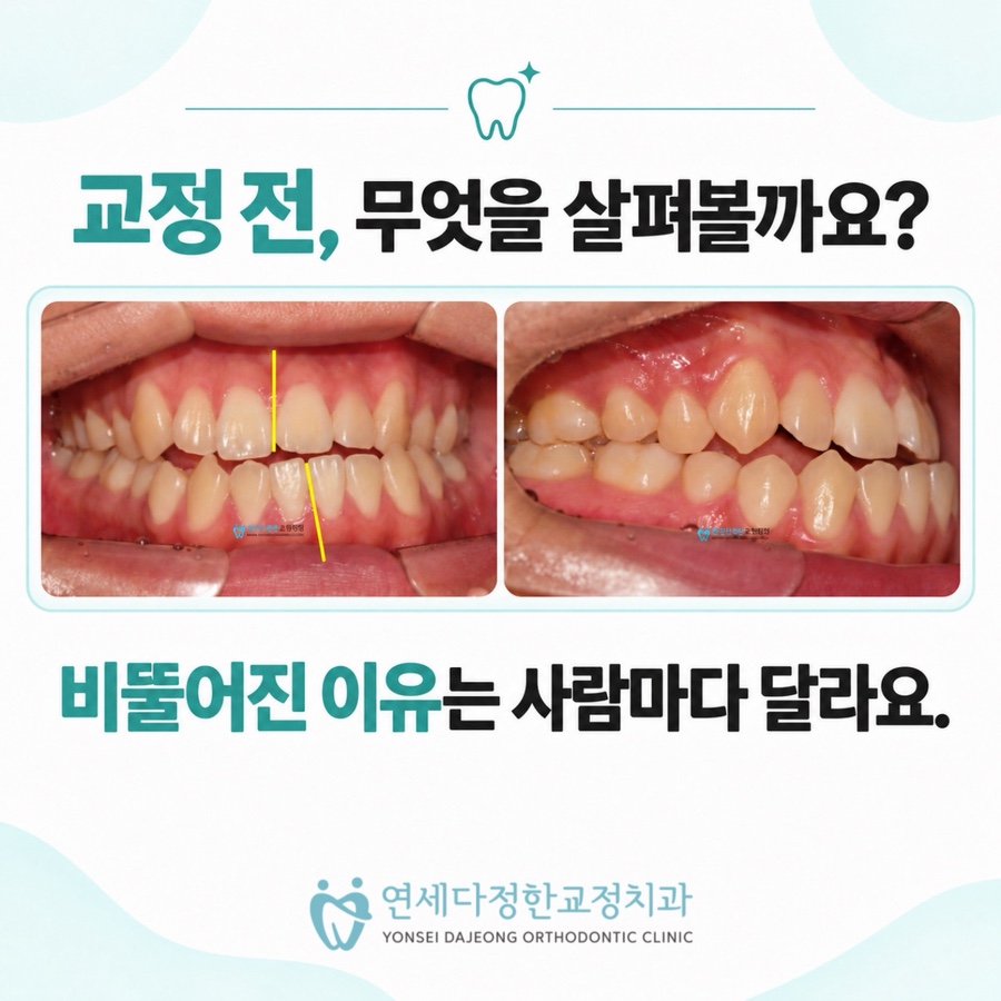 동대문 교정치과 관련 이미지 2