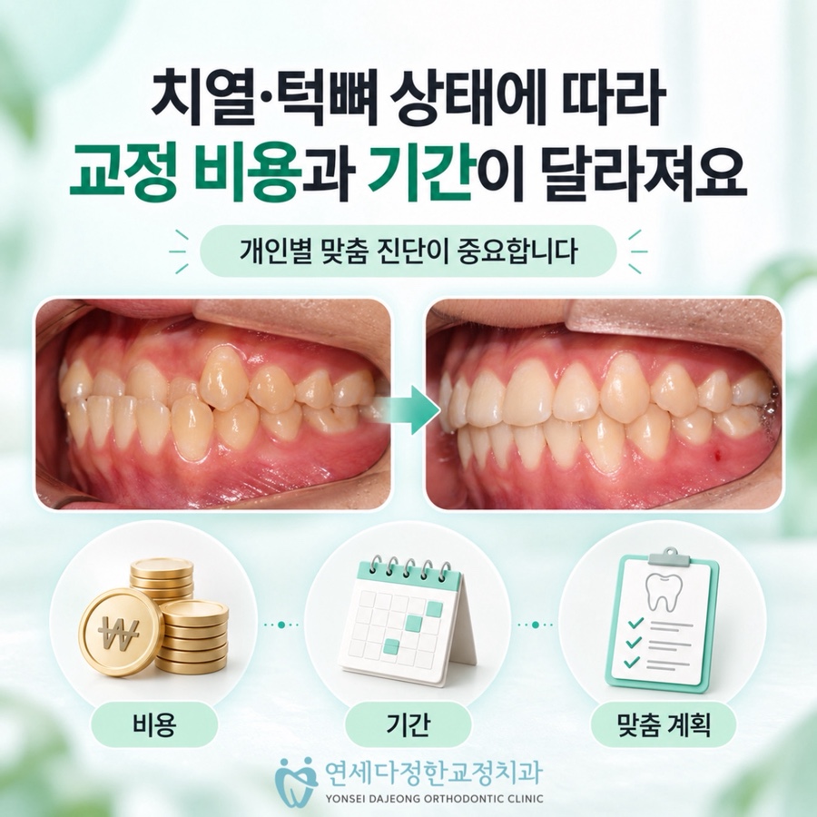 부정교합 치아교정 비용 관련 이미지 3