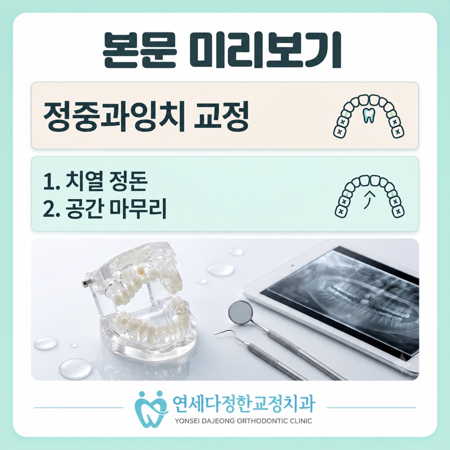 정중과잉치 관련 이미지 3