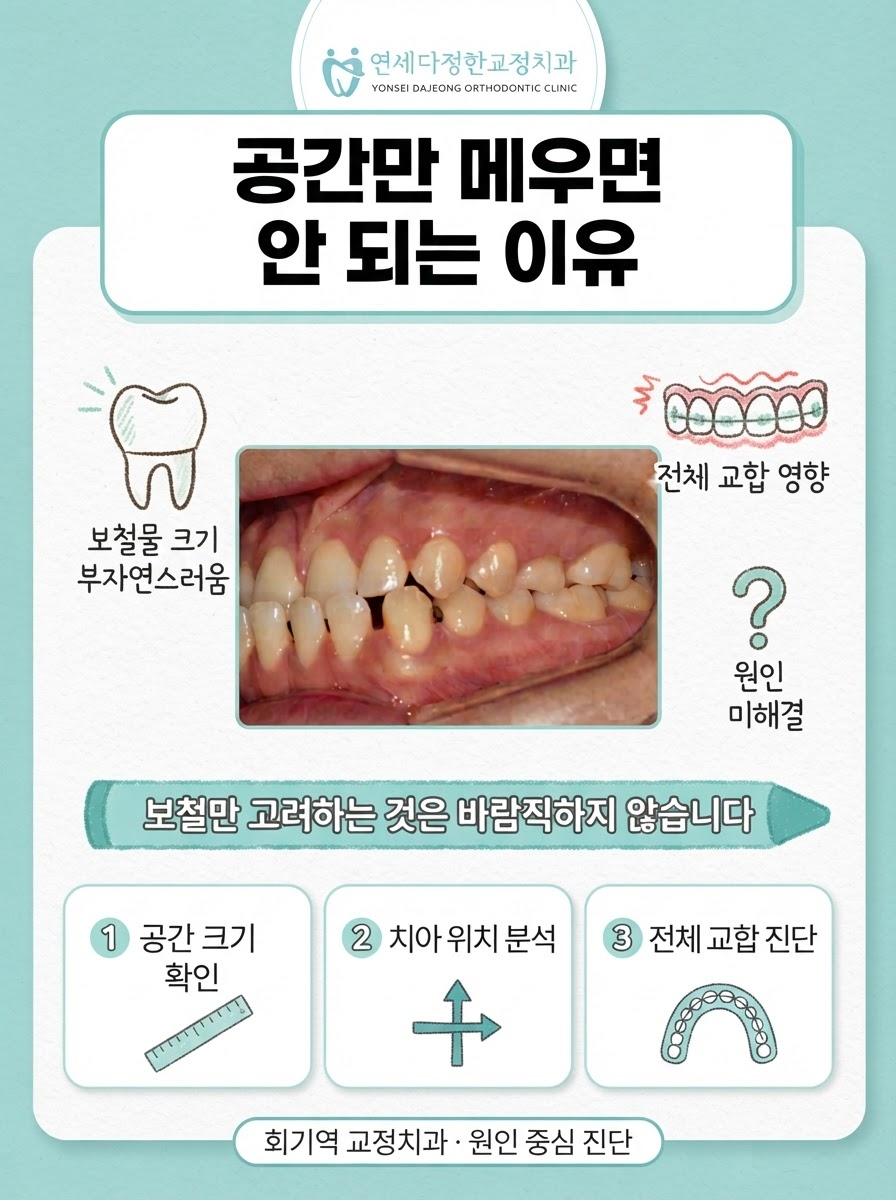 회기역 교정치과 관련 이미지 5