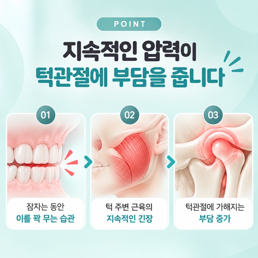이갈이 스플린트 관련 이미지 8