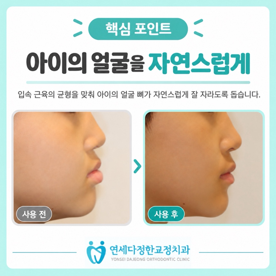 프리올소 효과 관련 이미지 7