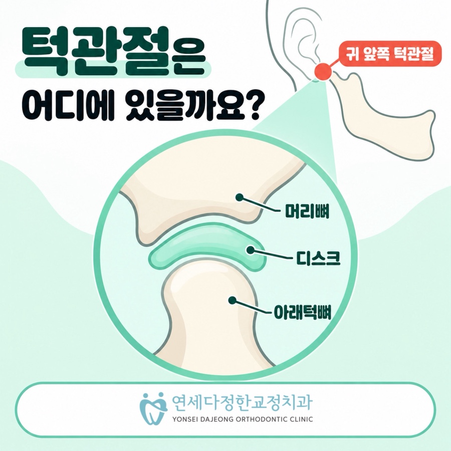 턱관절 두통 관련 이미지 7