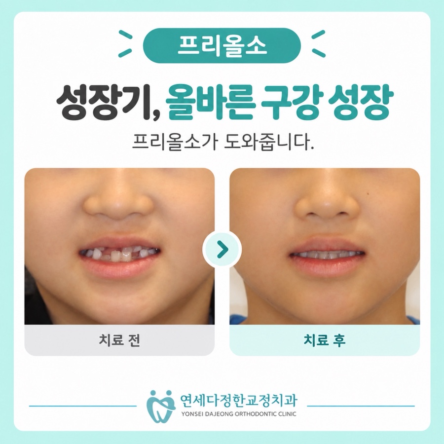 프리올소 효과 관련 이미지 8