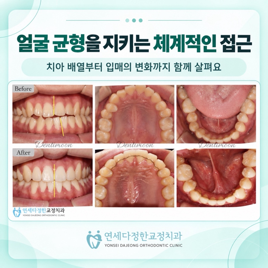 동대문 교정치과 관련 이미지 9
