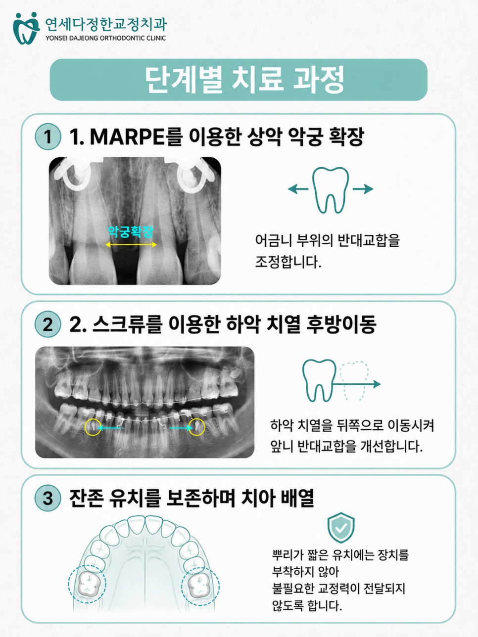 회기역 교정치과 관련 이미지 9