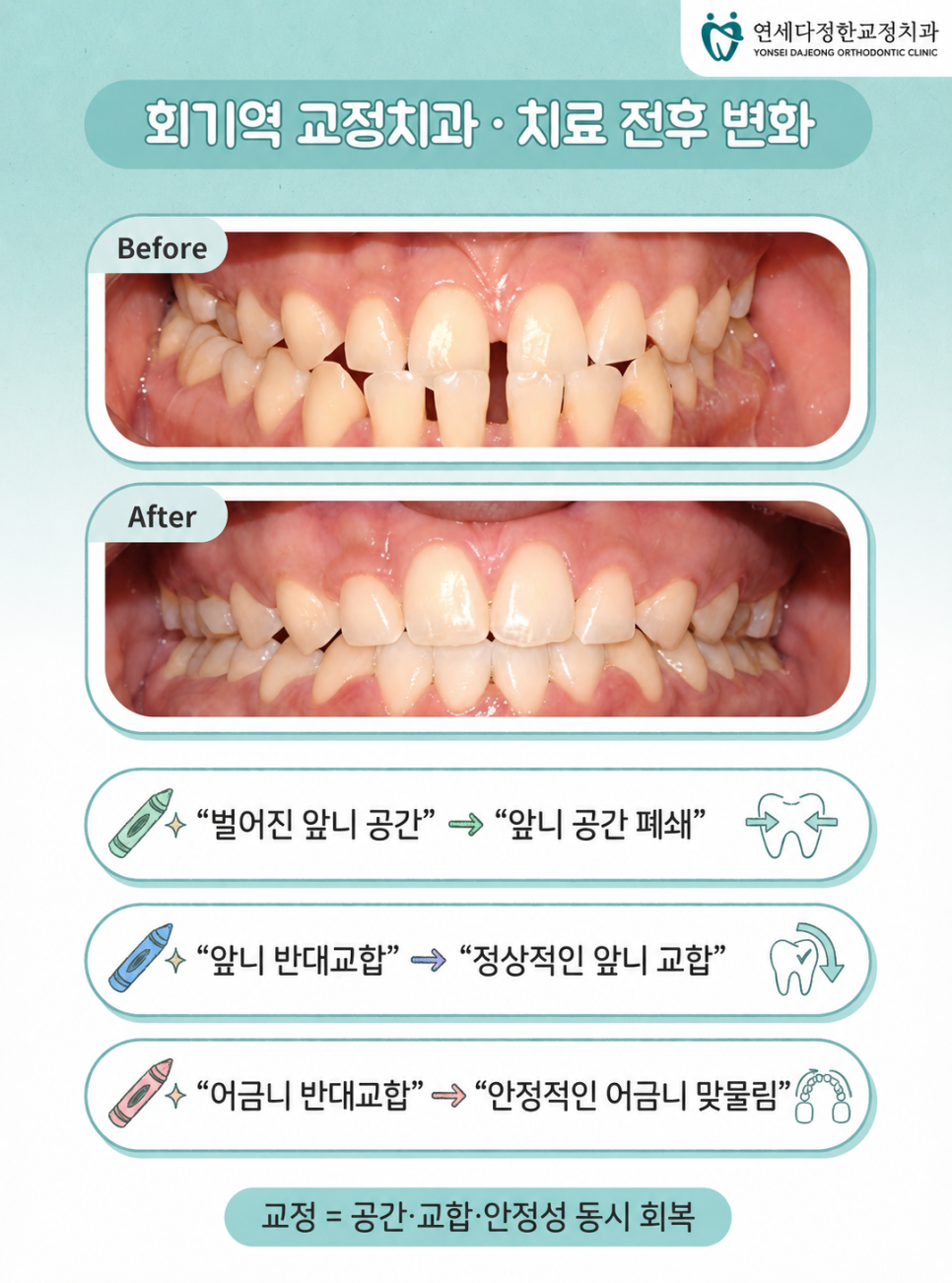 회기역 교정치과 관련 이미지 11