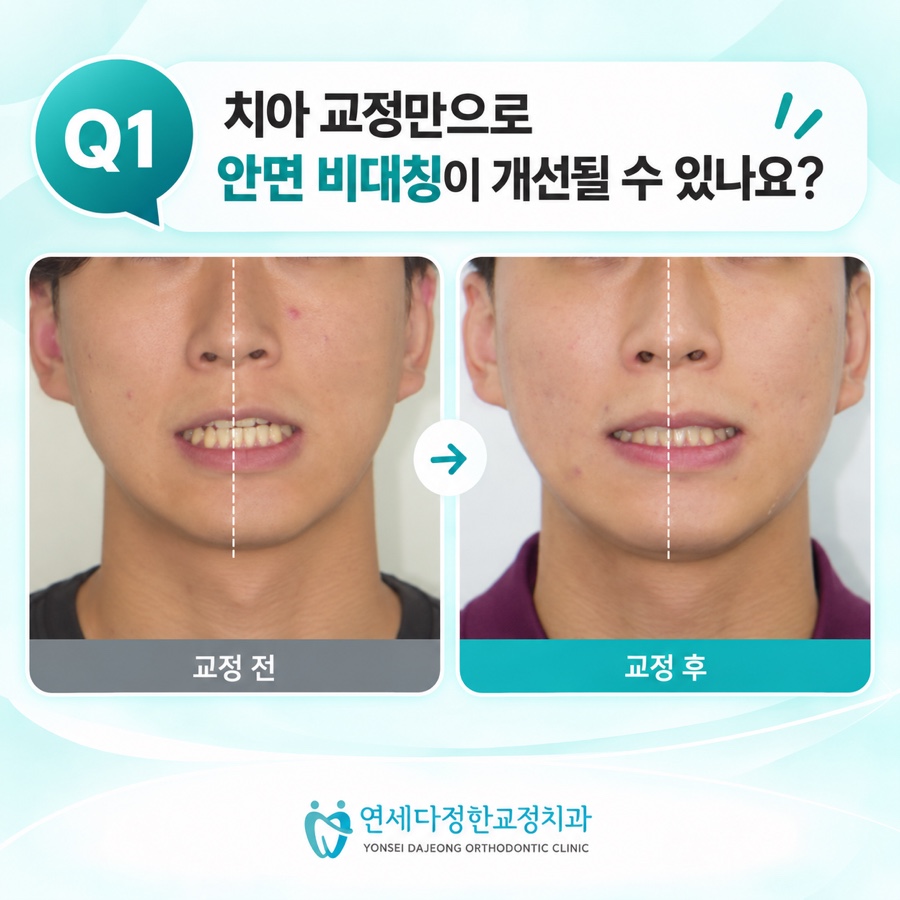 동대문 교정치과 관련 이미지 13