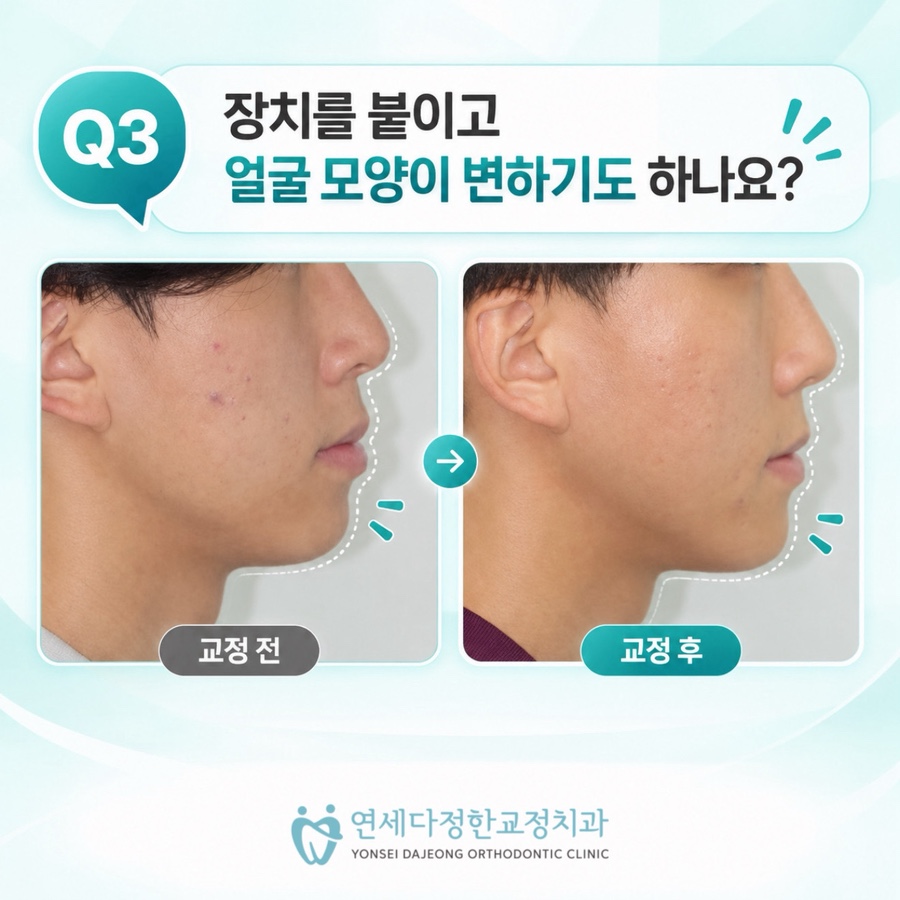 동대문 교정치과 관련 이미지 15