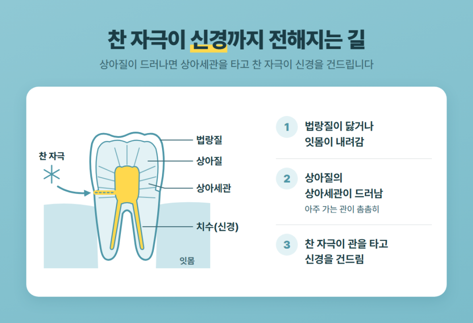 시린이 신경치료 관련 이미지 2