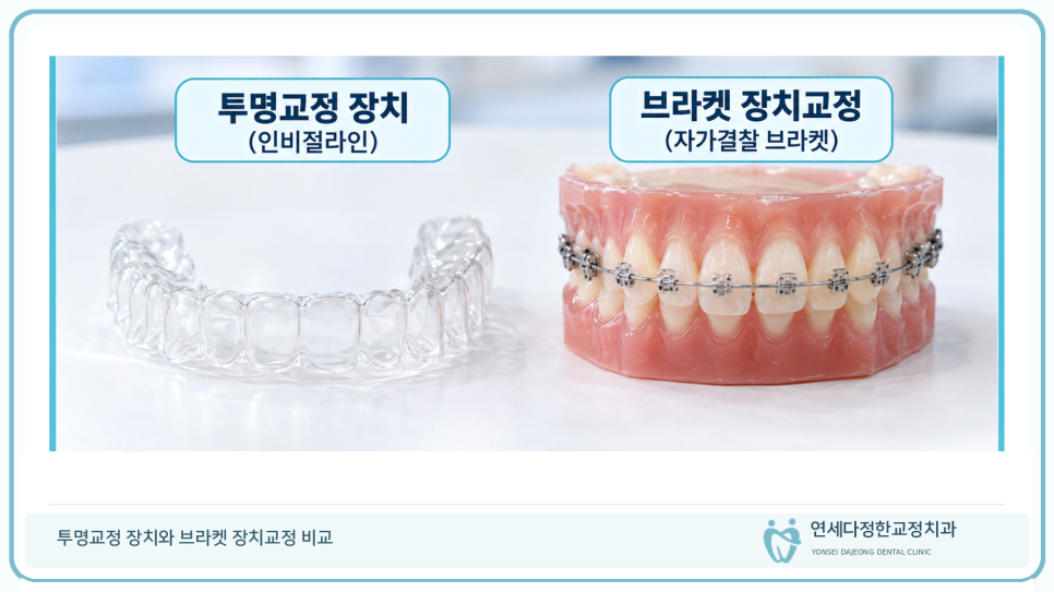 투명교정 장치교정 비교 관련 이미지 2