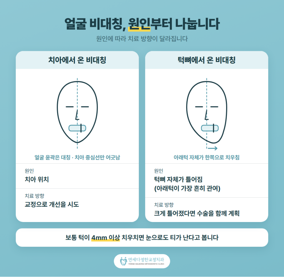 주걱턱 선수술교정 관련 이미지 3