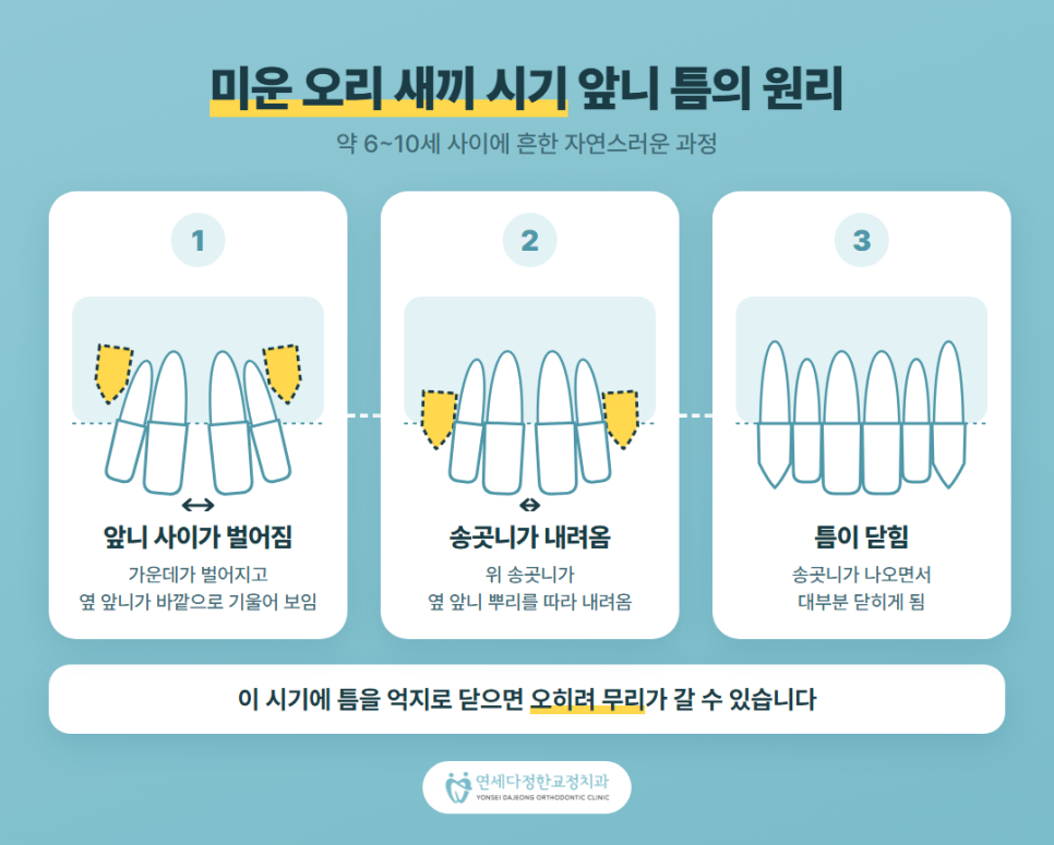 영구치 나오는 순서 관련 이미지 4
