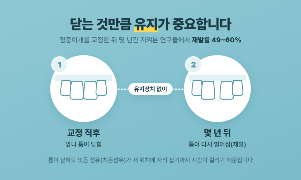 앞니 벌어짐 교정 관련 이미지 6
