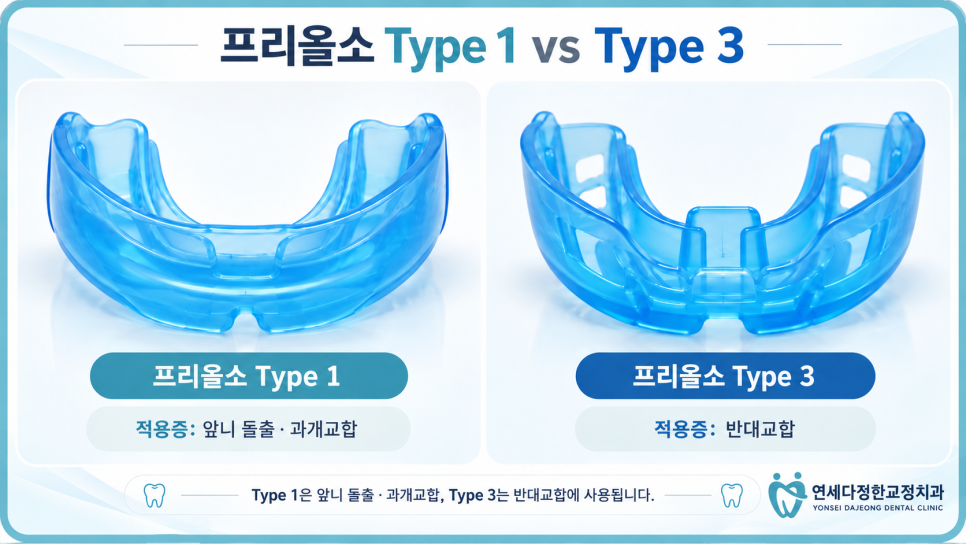 어린이 앞니 돌출 관련 이미지 6