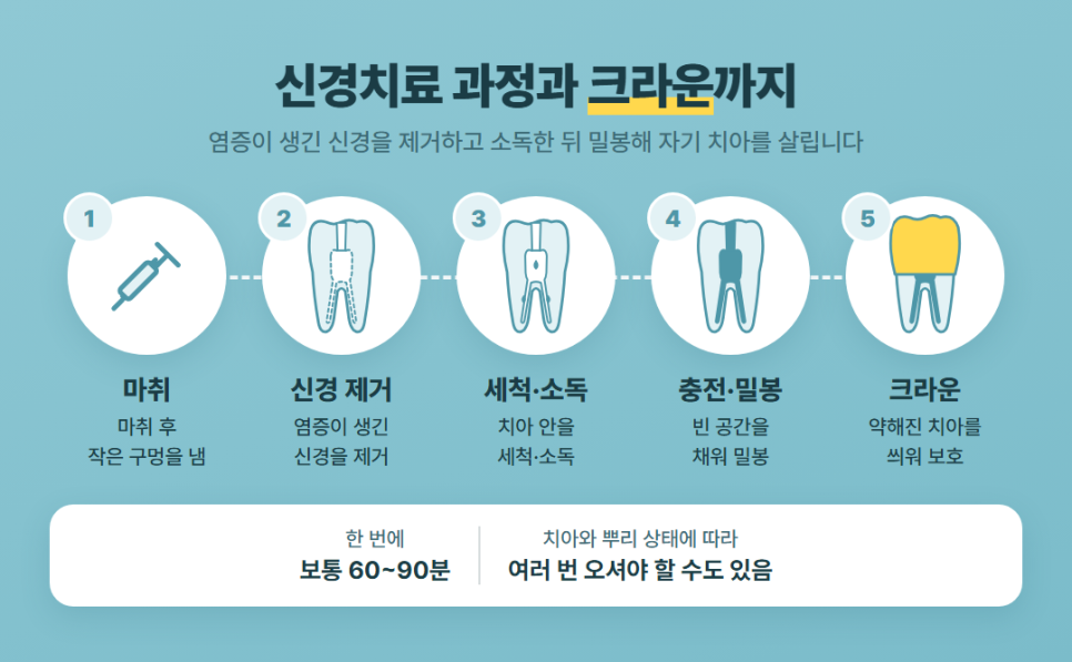 시린이 신경치료 관련 이미지 7